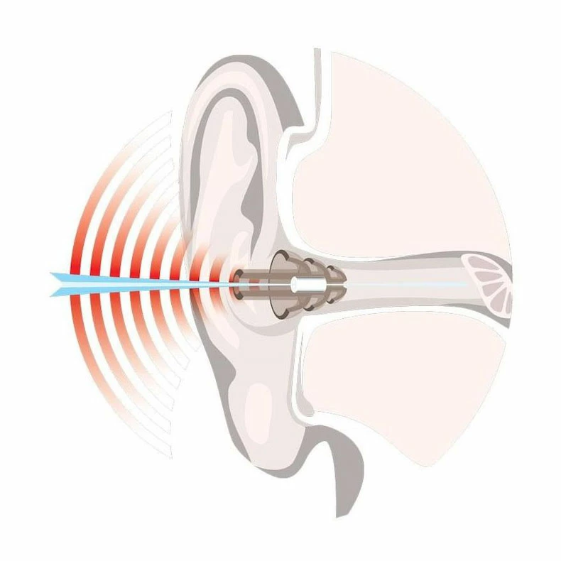 NoNoise Earplugs Sleep Noise Filter Ear Protection 5 NoNoise Earplugs Sleep Noise Filter Ear Protection - Image 3